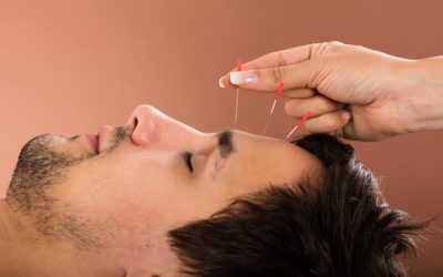 Where To Get Professional Acupuncture In Costa Mesa CA