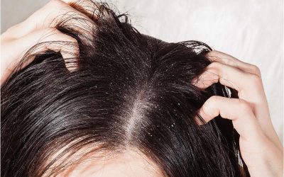 Restore Confidence with Hair Treatment St Johns FL for Lasting Results and Healthy Shine