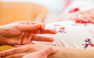 Find Relief Through Acupuncture For Stress Bellingham WA Residents Trust For Wellness