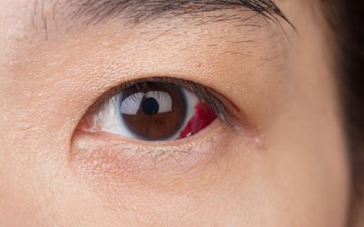Choosing the Right Clinic for Effective Ocular Disease Management in Ohio