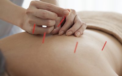 The Benefits You Can Expect from an Acupuncture Clinic in Westford, MA: Experience