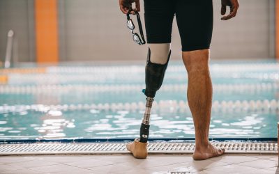 Patient Success Stories Featuring Prosthetic Care Services in Nampa, ID, for Recovery