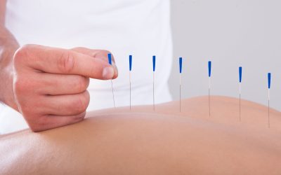 Boost Performance With Acupuncture Treatment for Athletes in Woodbine, MD, for Pain Relief