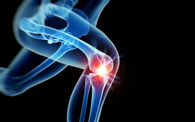 Finding Lasting Relief for a Bulging Disc in Conway, AR with Proven Methods