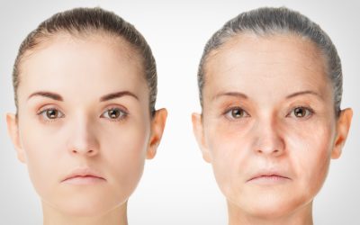Get Real Results with Morpheus8 Riverside, CA for Aging and Sun-Damaged Skin