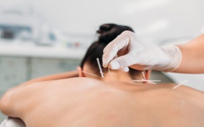 Experience Pain Relief with an Acupuncture Specialist in Newark, CA for Enhanced Wellness